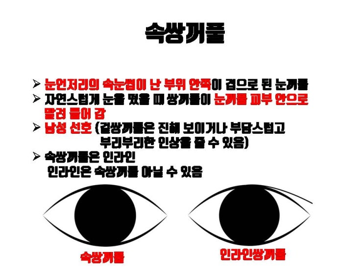  쌍꺼풀 수술 후 헷갈리는 겉쌍, 속쌍, 무쌍의 차이 완벽히 알려 드려요!!!