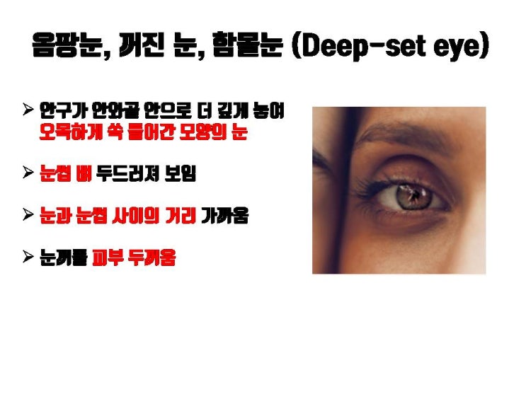  옴팡눈, 함몰눈, 꺼진 눈은 쌍수 망하는 눈?