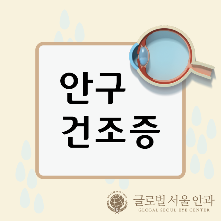  안구건조증 걱정하고 있다면