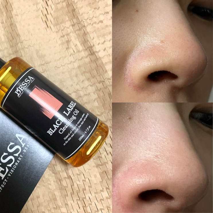 피지녹이는 제품 지성 클렌징오일 추천 데싸 블랙라벨 산뜻한 마무리 피지녹이는 제품 지성 클렌징오일 추천 데싸 블랙라벨 산뜻한 마무리