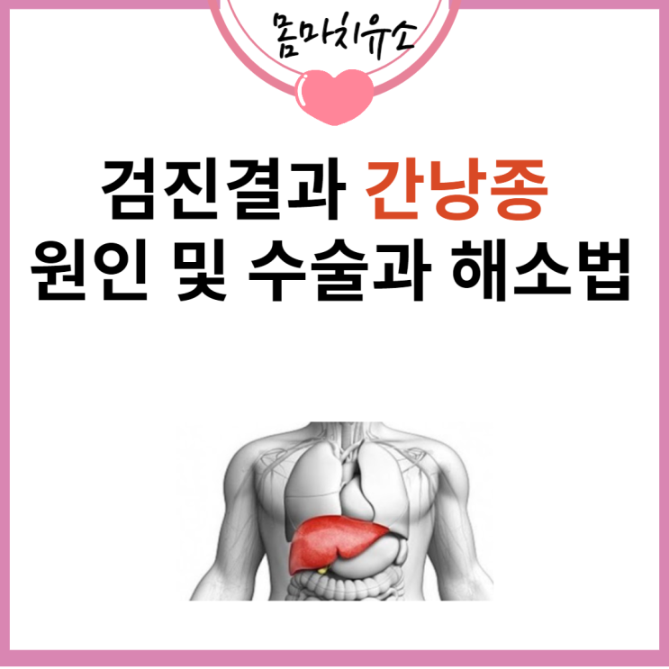 검진결과 간낭종 원인 및 수술과 해소법