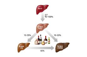  알콜성 간염질환 원인 증상특징 병원치료방법 예후경과 지방간간암합병증 과다음주 간호중재진단과정