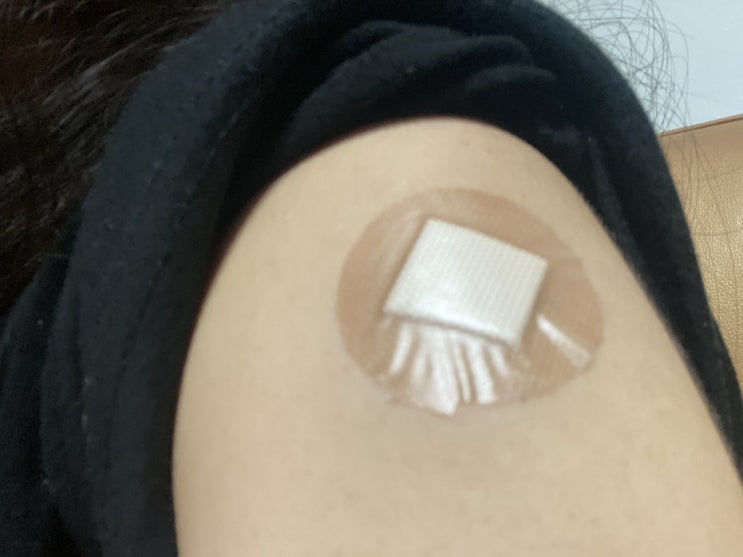  코로나19 화이자 1차 백신 미열과 팔통증