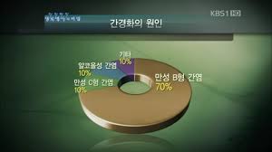  간경화 원인증상징후 진단검사치료 간구조기능역할 초기말기진행 간경화경과예후 복수황달섬유화 문맥압정맥류