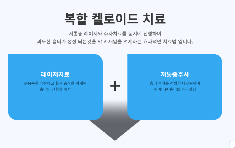 방배동 연세스타피부과 켈로이드 흉터 치료는 레이저와 저통증주사 복합치료로 효과 볼 수 ....