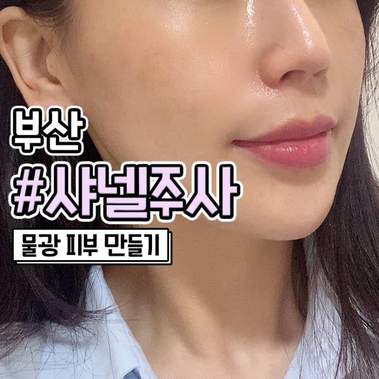  부산샤넬주사 지우개주사 후기 사진 有