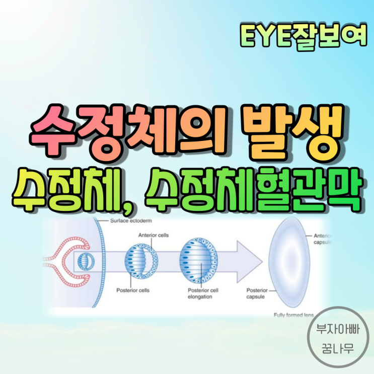  [EYE잘보여] 수정체(Lens)의 발생 - 수정체, 수정체혈관막(Tunica Vasculosa Lentis), 섬모체소대(Zonule)