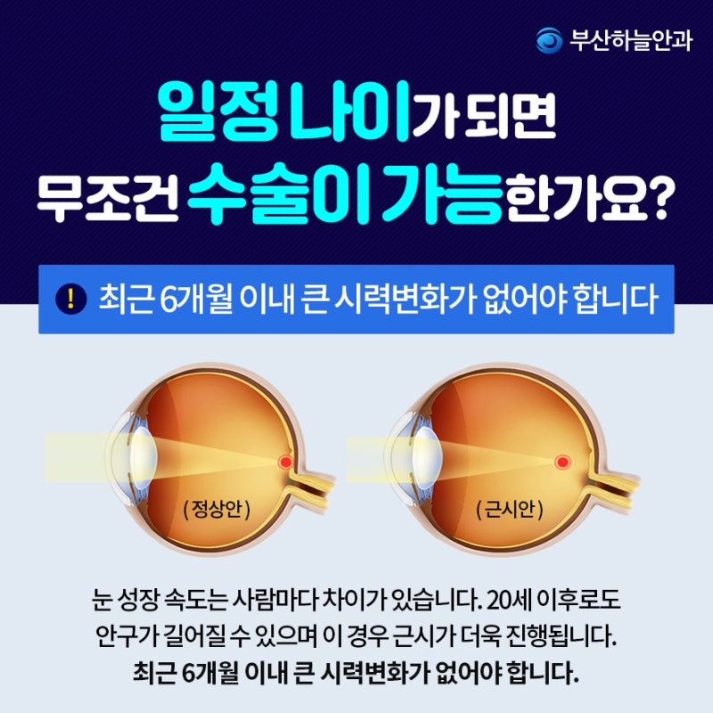 18세 19세도 라식라섹 가능할까 : 네이버 블로그 18세 19세도 라식라섹 가능할까 : 네이버 블로그