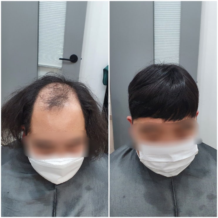  당일맞춤가발/두피에붙이는가발/레이스가발/자연스러운가발