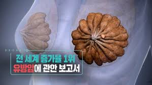  유방암 항암제호르몬치료 절제수술 자가진단 유방암생존율예후 유방절제술부작용 림프부종예방 간호중재