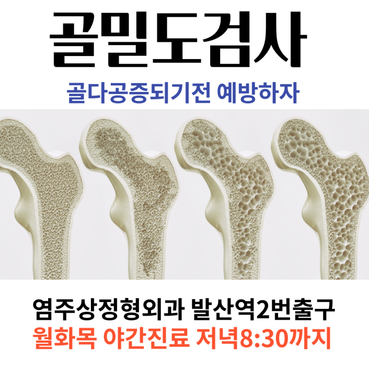  골밀도 검사비용 안내와 골다공증 예방 [마곡 발산역 염주상정형외과]