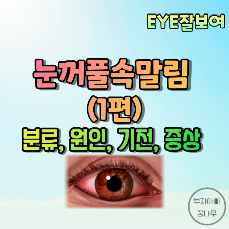 [EYE잘보여] 눈꺼풀속말림(안검내반, Entropion) (1) - 분류(종류), 원인, 기전, 증상(임상양상), 특징