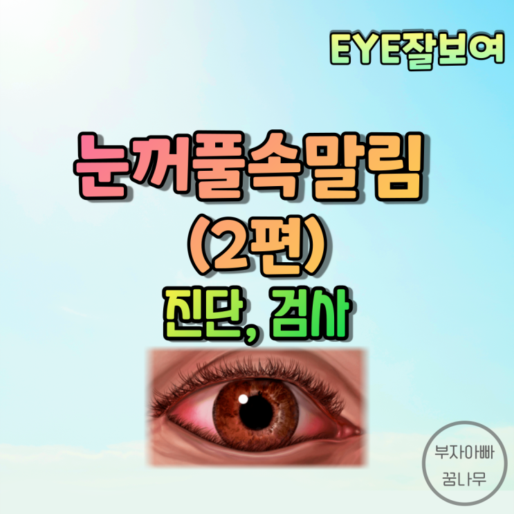 [EYE잘보여] 눈꺼풀속말림(안검내반, Entropion) (2) - 진단, 검사