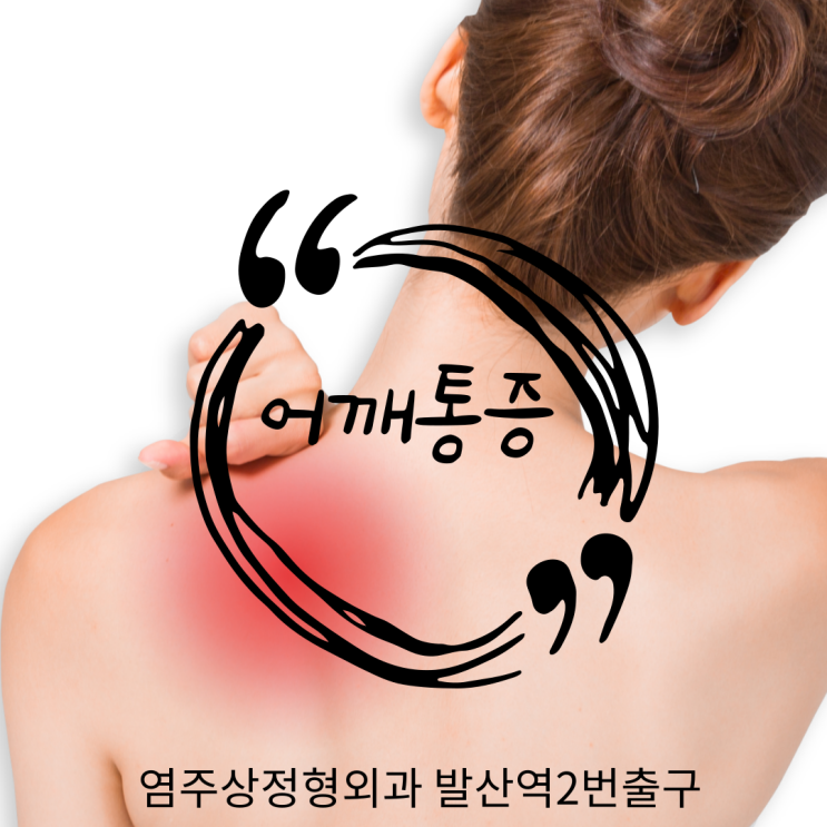  마곡정형외과, 어깨통증 회전근개파열 비수술치료 | 발산역염주상정형외과