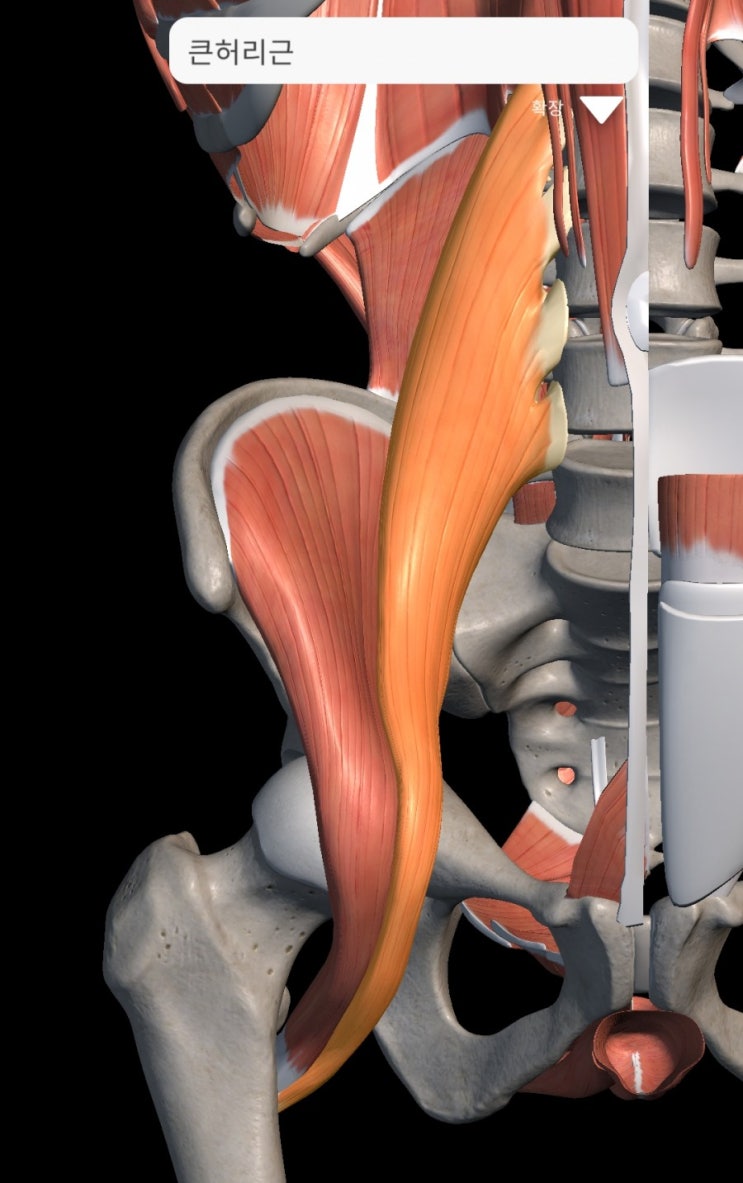  안양역한의원 - 장요근 증후군(iliopsoas muscle) - 급만성 요통 허리통증