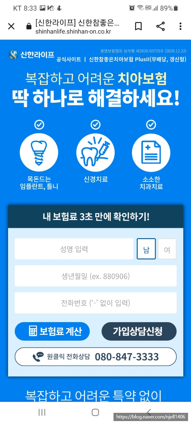 치아보험 리뷰