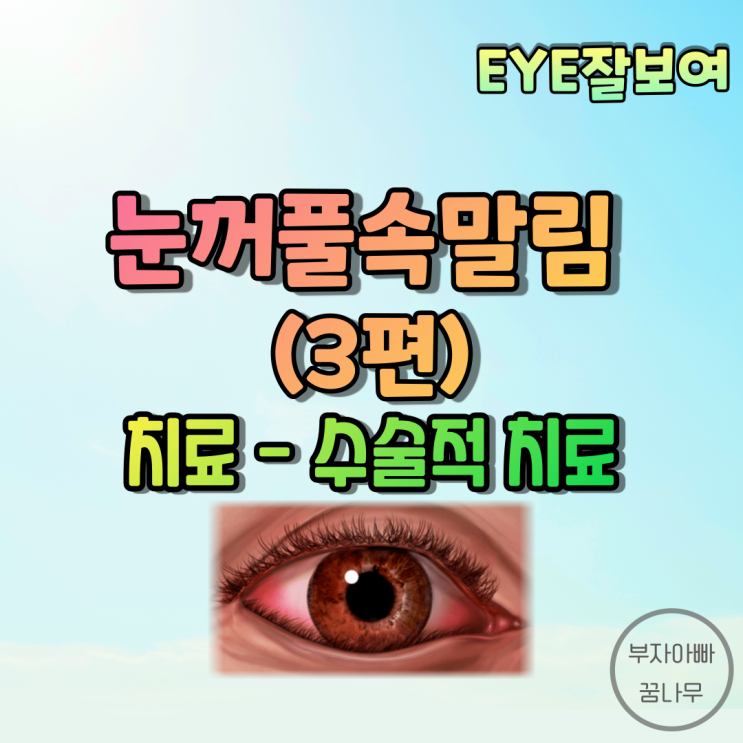 [EYE잘보여] 눈꺼풀속말림(안검내반, Entropion) (3) - 치료, 수술, 수술적 치료