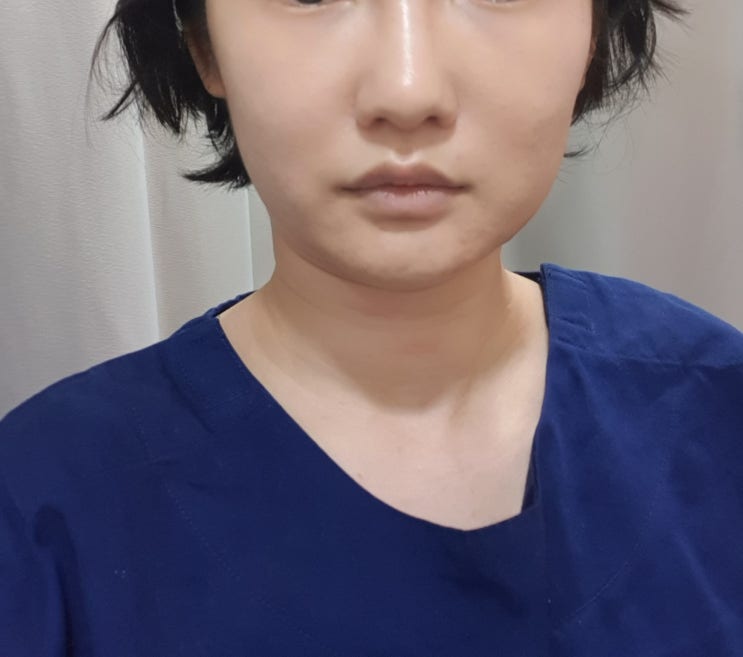  서초동 안면비대칭교정 1회교정 후기