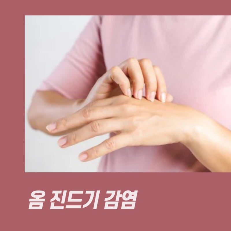 옴 증상 및 치료법 옴 진드기 전염 치료 후기 : 네이버 블로그