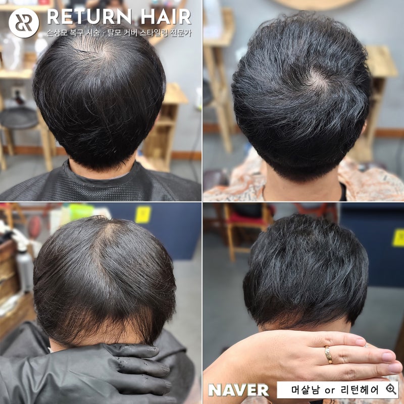 남성탈모펌, 크라운탈모, 남성파마, 탈모가 있는 분들을 위한 탈모펌 헤어스타일, 모발이식, 남성증모수술, 남성가발, 두피문신 추천드립니다. 남성탈모펌, 크라운탈모, 남성파마, 탈모가 있는 분들을 위한 탈모펌 헤어스타일, 모발이식, 남성증모수술, 남성가발, 두피문신 추천드립니다.