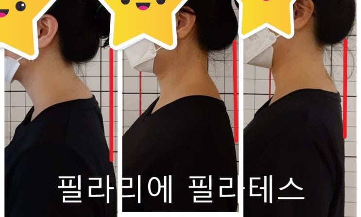  [이수역필라테스] 내가 거북목증후군에  버섯증후군이라고?   -  체크 한번 해볼까요?