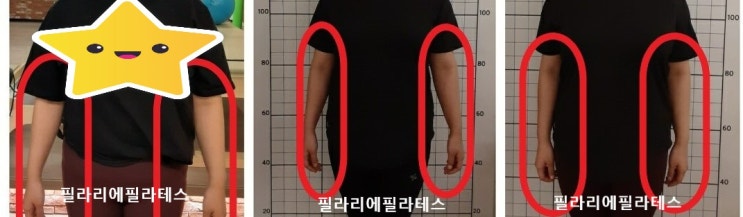 [이수역체형교정] 내 팔 모양은? 팔꿉관절 ( elbow joint )  관련 편
