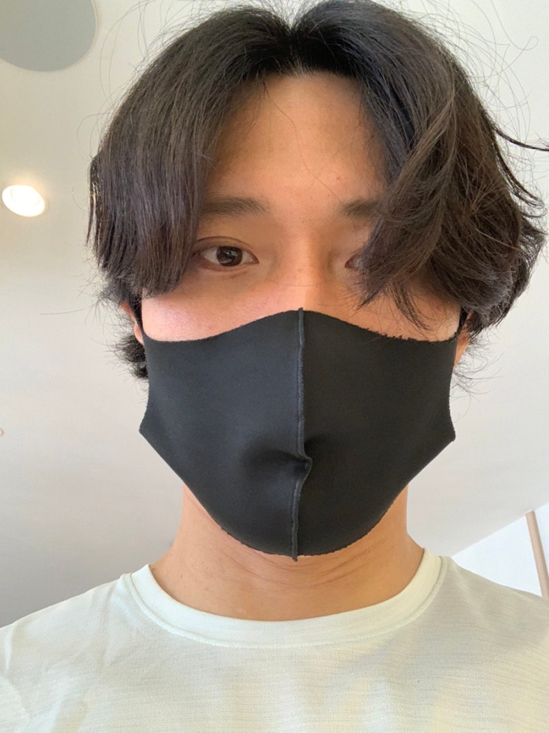 [익상편 군날개 제거 수술 후기 5개월 후] 추가 + 10 개월 후
