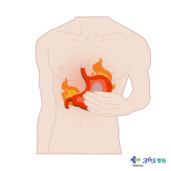  [창원마산 척추관절 디스크 365병원] 급성위염
