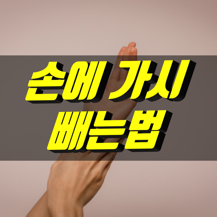 가시 박혔을때 가시 빼는법 정말 간단하게 가시 박혔을때 가시 빼는법 정말 간단하게
