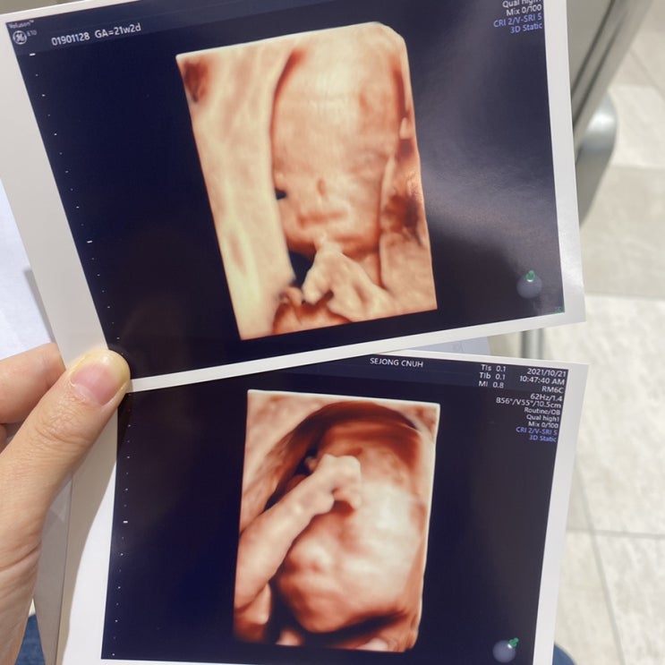  현재 두 자매 아빠, 2022년 3남매 아빠 예정