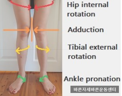 (응암동pt) X자 다리 교정운동 전략! 외반슬을 유발하는 근육들과 운동방법! 2
