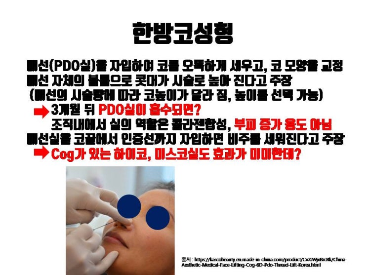  한방 코성형을 받는 것보다는 비용, 효과 면에서 코수술을 받는게 훨씬 나아요!!!