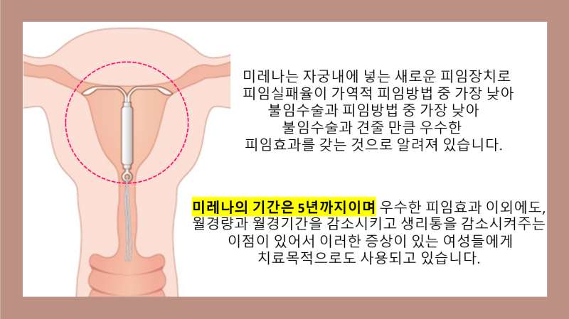 미레나피임효과 나에게 필요한 10