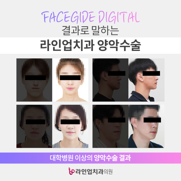  수 백, 수 천 번을 고민했던 양악수술은 잘하는 곳에서!