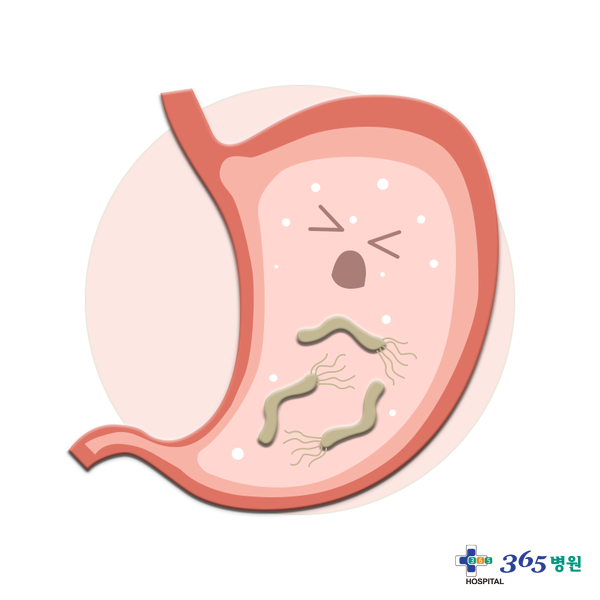  [창원마산 척추관절 디스크 365병원] 헬리코박터 파이로리균