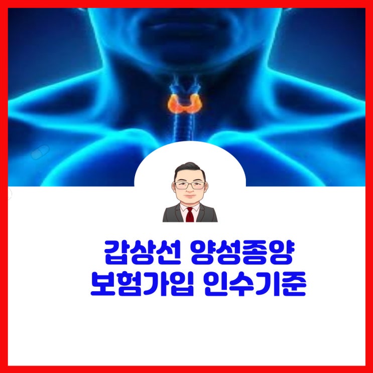  갑상선양성종양 갑상선결절 보험가입 인수기준이 어떻게 되나