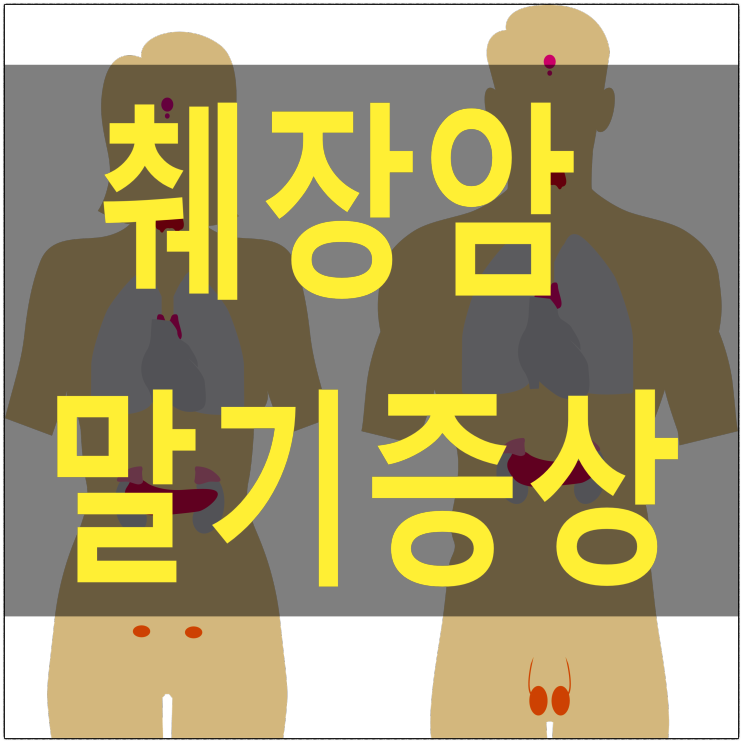 췌장암 말기 증상이 나타나면 항암을 하면서 추가로 해야 하는 것에 대해 어떤 순서로 하는 것이 도움이 많이 될지 알아봅시다.