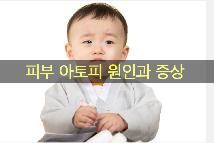  피부 아토피 원인과 증상 & 좋은 음식, 영양제