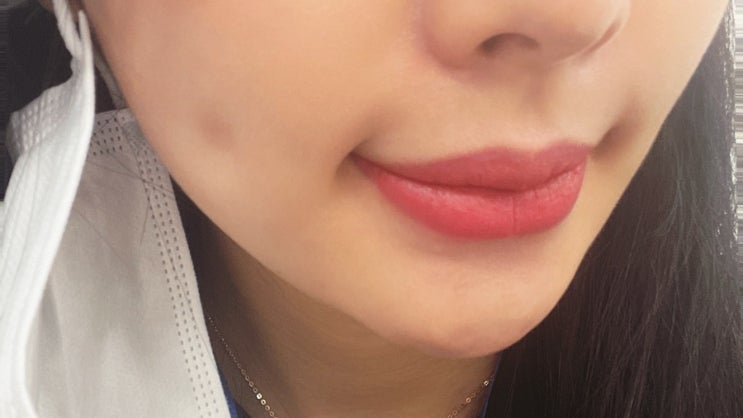  입술반영구 1년후 리터치 후기 :군자 오케이메디컬뷰티센터
