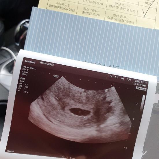 임신/ 두 번째 임신, 둘째가 찾아왔다. 임신/ 두 번째 임신, 둘째가 찾아왔다.