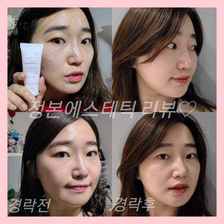  예신 얼굴작아지기 경락1일차~3일차 with.정본에스테틱 강남