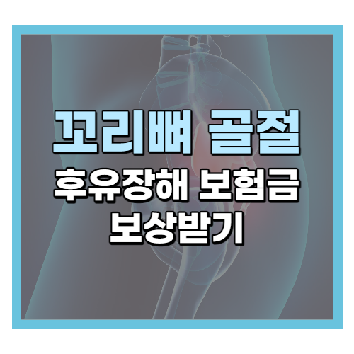  꼬리뼈 골절, 장해보험금 받을 수 있다