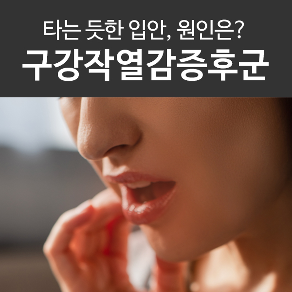  구강작열감증후군, 타는 듯한 혓바닥 따가움의 원인은?