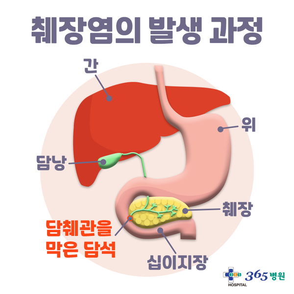 [창원마산 척추관절 디스크 365병원] 췌장염