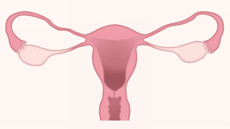 배에 복수가 차서 복막암이 힘들다면 어떤 치료의 방향을 찾아야 할까