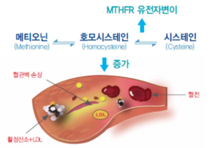  호모시스테인 Homocysteine