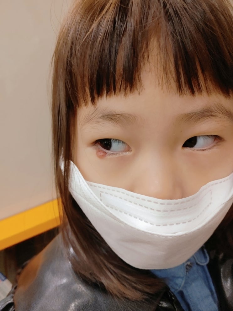  4살 아기 눈 다래끼 부산 이영안과에서 치료 받았어요