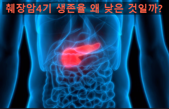  췌장암 4기 생존율 면역치료를 하면 어떻게 올라가며 또 올라가는 정도를 어떻게 알 수 있을까?
