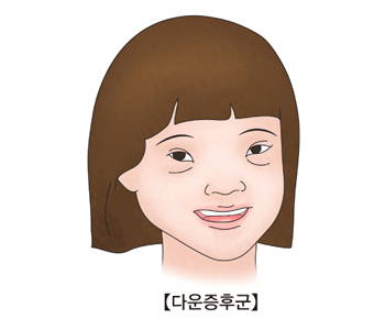  4-4. 다양한 유전병 (염색체 수 이상)