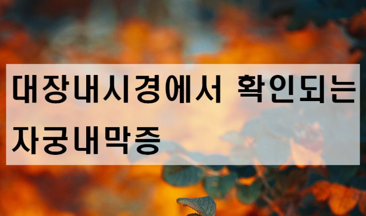 대장내시경 - 대장에서 확인되는 자궁내막증